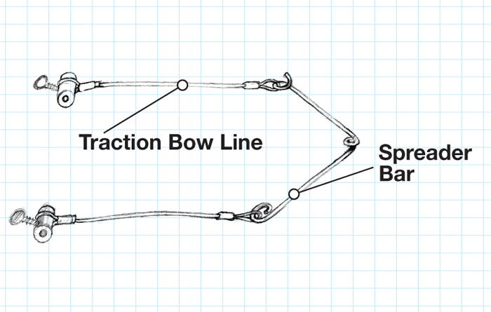Disposable Traction Bow with Spreader Bar